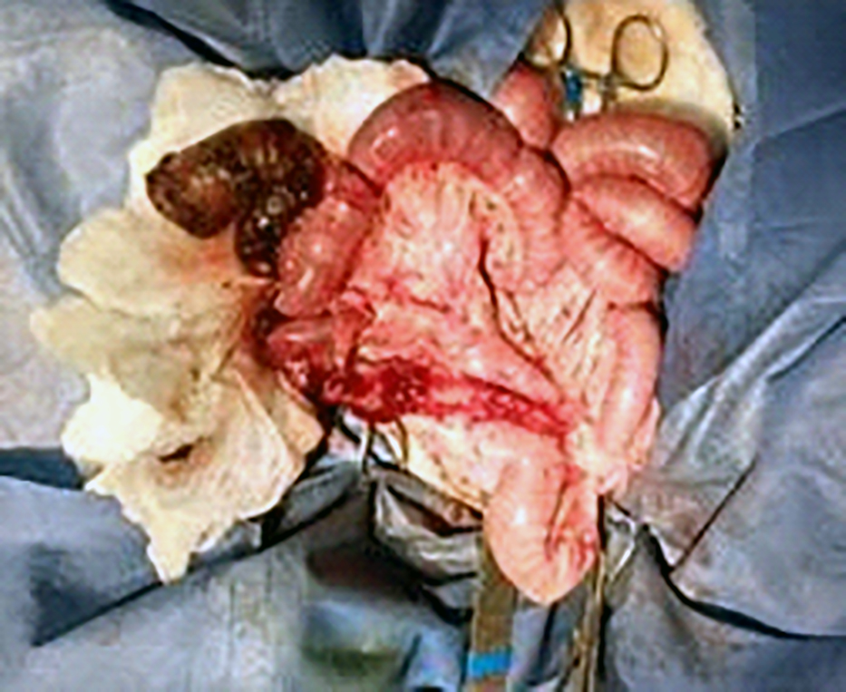 cirugia3