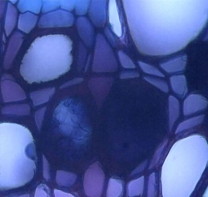 Cross section of Solanum tuberosum stem with obstruction of xylem vessels due to infection with P. carotovorum
